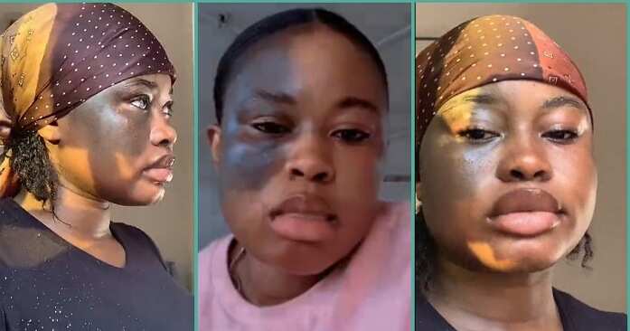 "Everyone Stares at Me When I Expose it": Video of Nigerian Lady With Unusual Birthmark Goes Viral