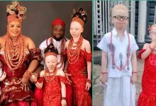 "Don't give them salt": Reactions as Nigerian couple shows off 3 albino kids