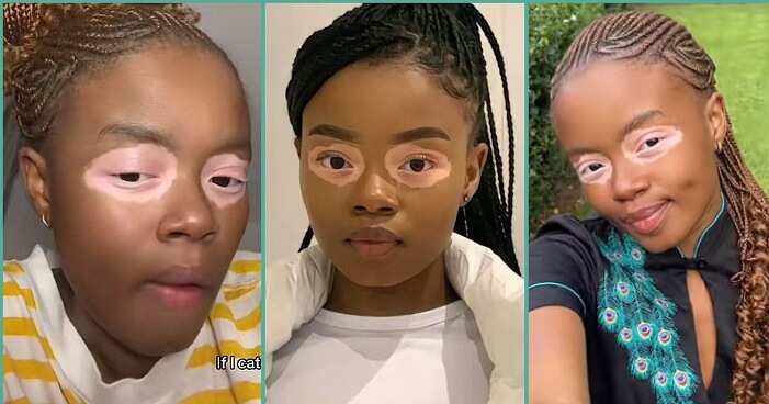 "It's Not Bleaching": Lady With Shiny Circle Around Her Eyes Flaunts Unique Beauty, Video Trends
