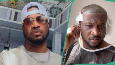 Peter PSquare Undergoes Hair Transplant, Shares Reason in Viral Video: “This One No Wan Grow Old”